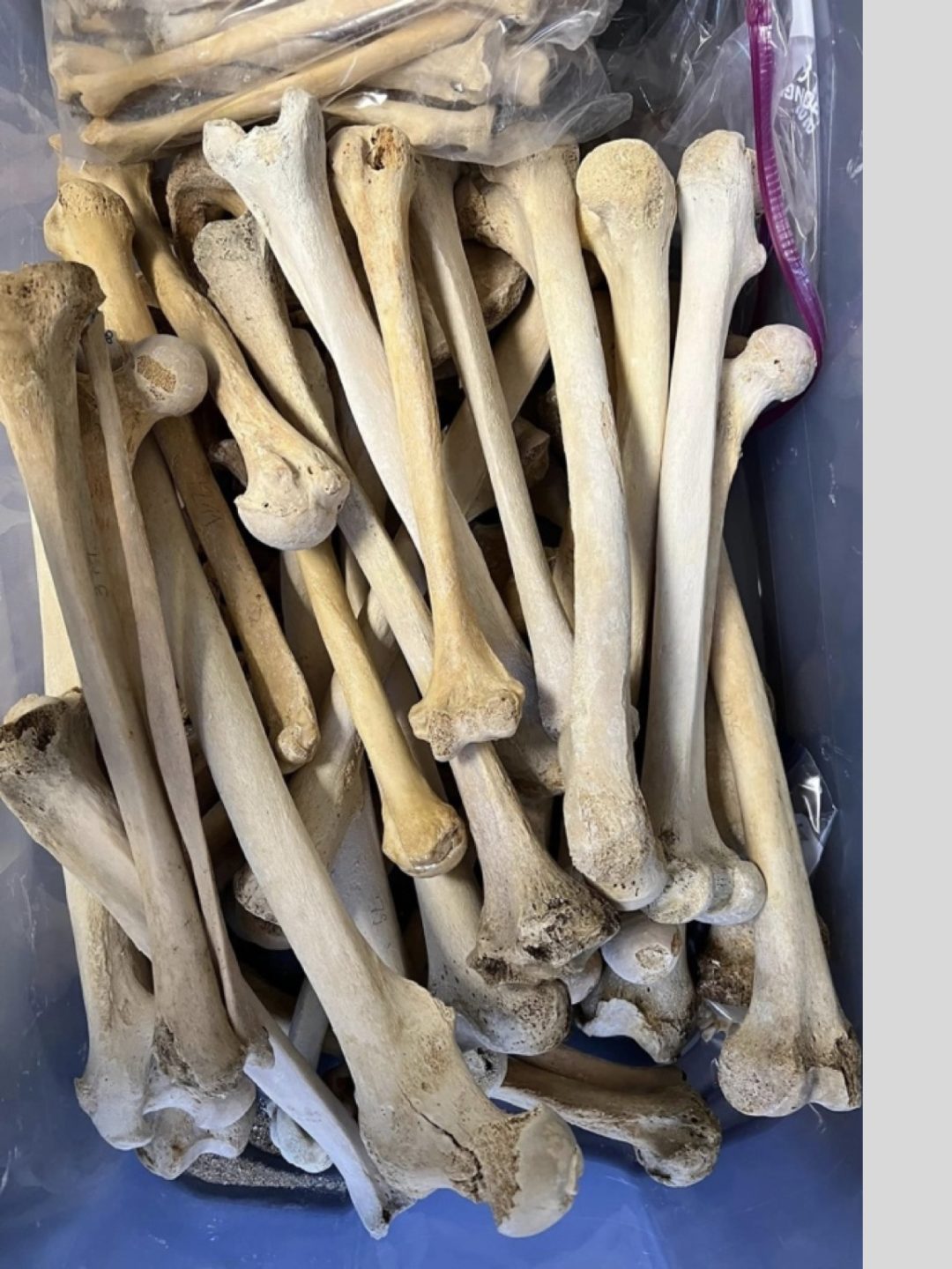 驚天丑聞！頂級(jí)高校實(shí)驗(yàn)室被曝倒賣(mài)遺體，6人已被逮捕